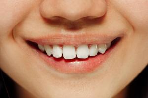 Tíz titok a fehérebb fogakért